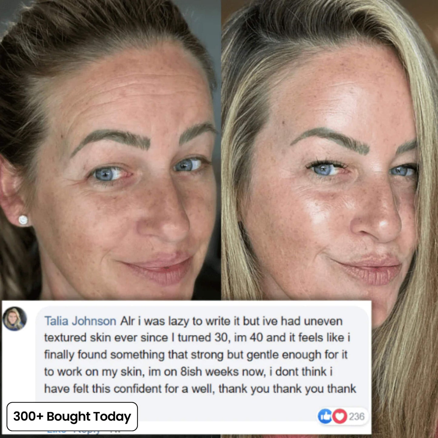 Transform Wrinkles, Fine Lines, And Tired Creases Naturally